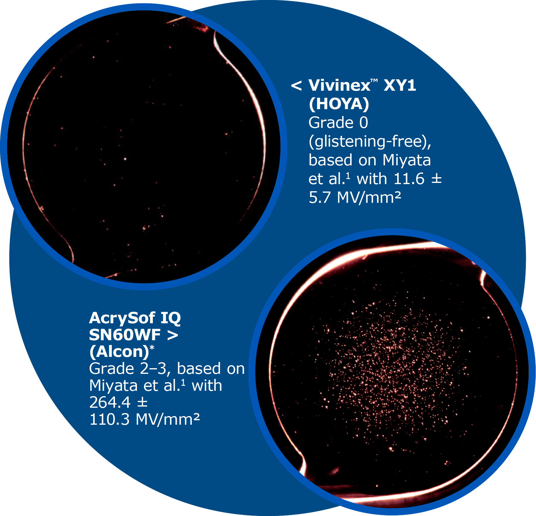 vivinex-iol-hoya-surgical-optics